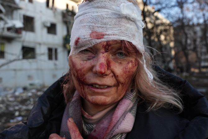 Se ve a una mujer herida después de que un ataque aéreo dañó un complejo de apartamentos en las afueras de Kharkiv, Ucrania, el 24 de febrero.