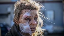 TOPSHOT - A wounded woman stands outside a hospital after the bombing of the eastern Ukraine town of Chuguiv on February 24, 2022, as Russian armed forces attempt to invade Ukraine from several directions, using rocket systems and helicopters to attack Ukrainian position in the south, the border guard service said. - Russia's ground forces crossed into Ukraine from several directions, Ukraine's border guard service said, hours after President Vladimir Putin announced the launch of a major offensive. Russian tanks and other heavy equipment crossed the frontier in several northern regions, as well as from the Kremlin-annexed peninsula of Crimea in the south, the agency said. (Photo by Aris Messinis / AFP)