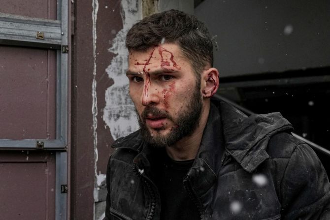 Un hombre herido sale del edificio. Evgeniy Maloletka/AP