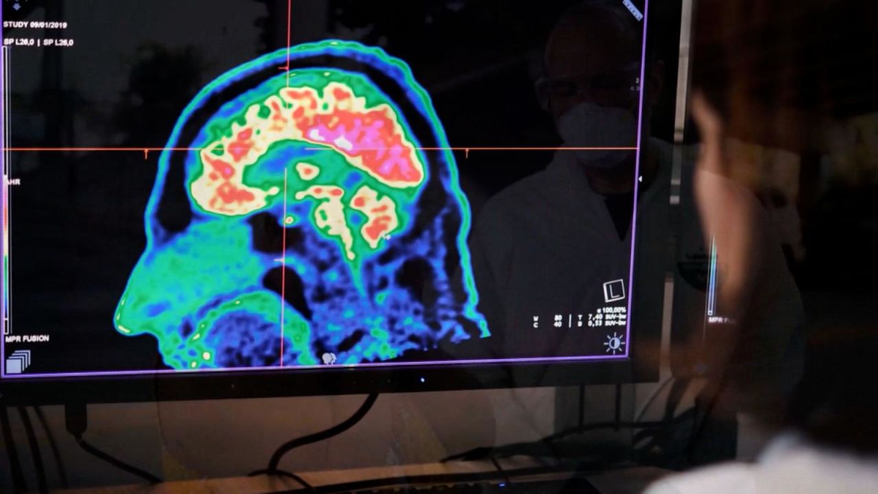 CNNE 1166953 - el estres puede cambiar su cerebro