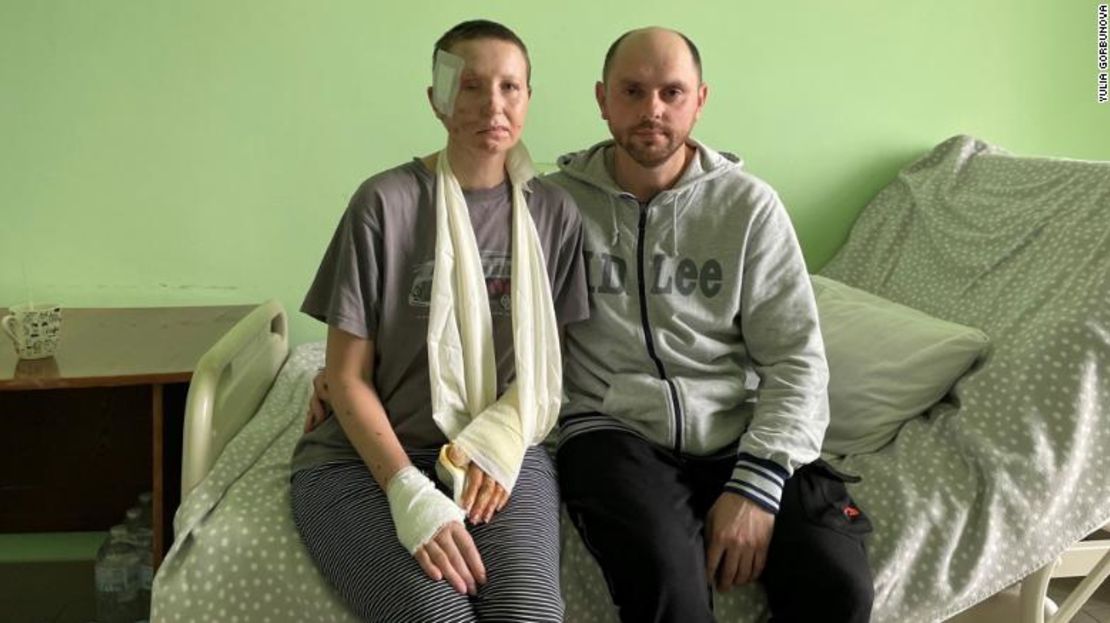 Nataliya, que está en un hospital de Lviv con su marido Andrii, perdió el ojo derecho durante un ataque en Mariúpol a mediados de marzo.