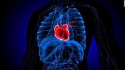 CNNE 1214388 - sindrome-corazon-roto