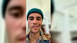 CNNE 1222331 - justin bieber explica la condicion medica que padece