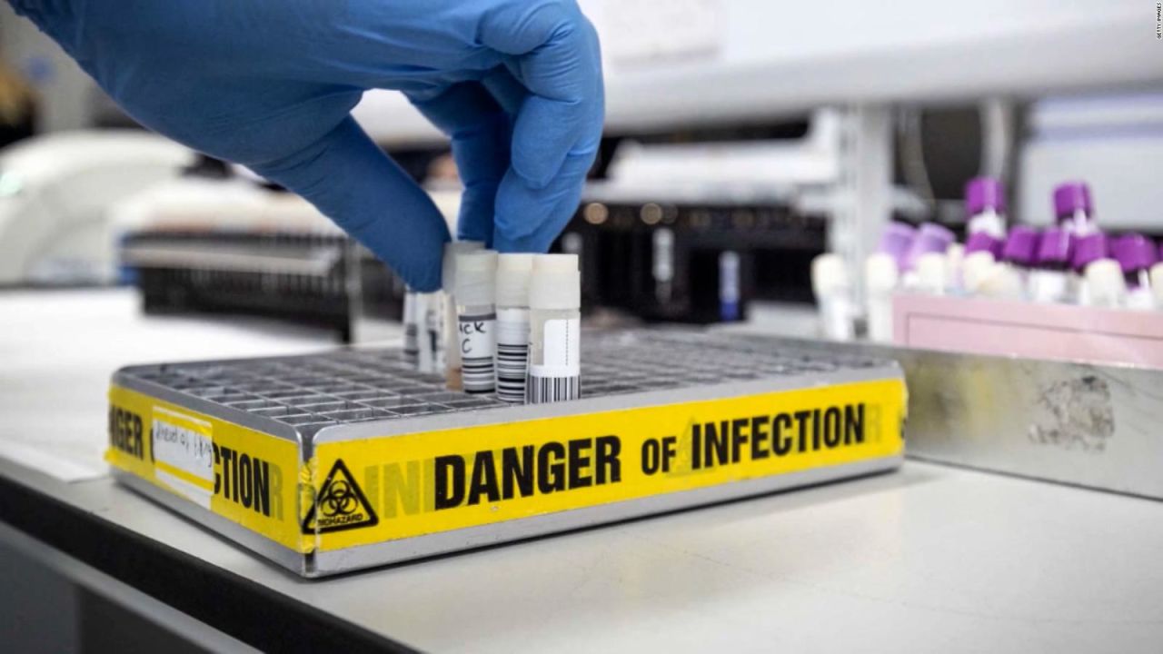 CNNE 1239868 - ¿cuales son los sintomas del virus mortal de marburgo?