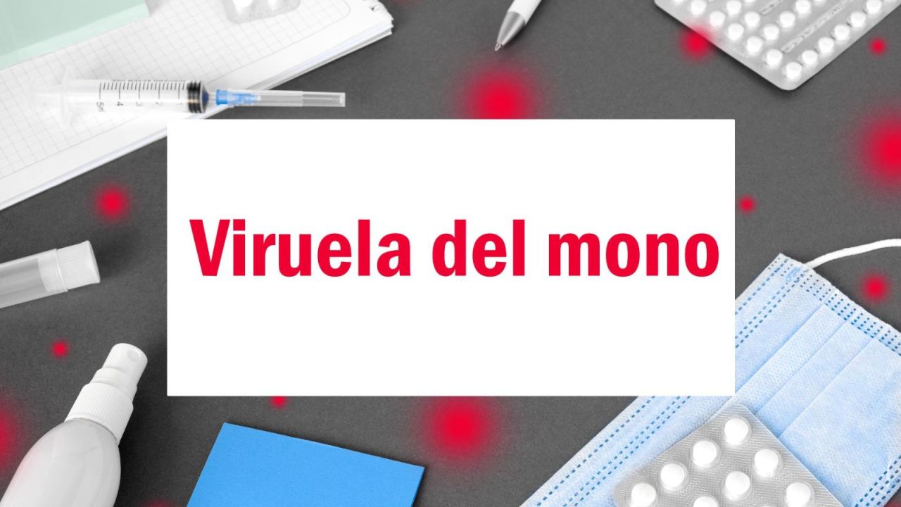 CNNE 1249135 - ¿que sabemos de la viruela del mono? el dr- huerta aclara las dudas