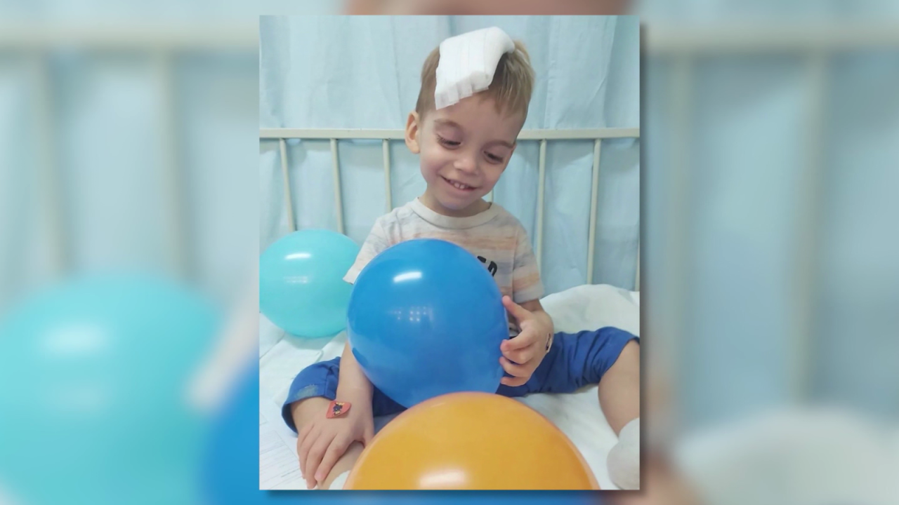 CNNE 1290522 - un "milagro" para oliver- mira su lucha para eliminar un tumor cerebral