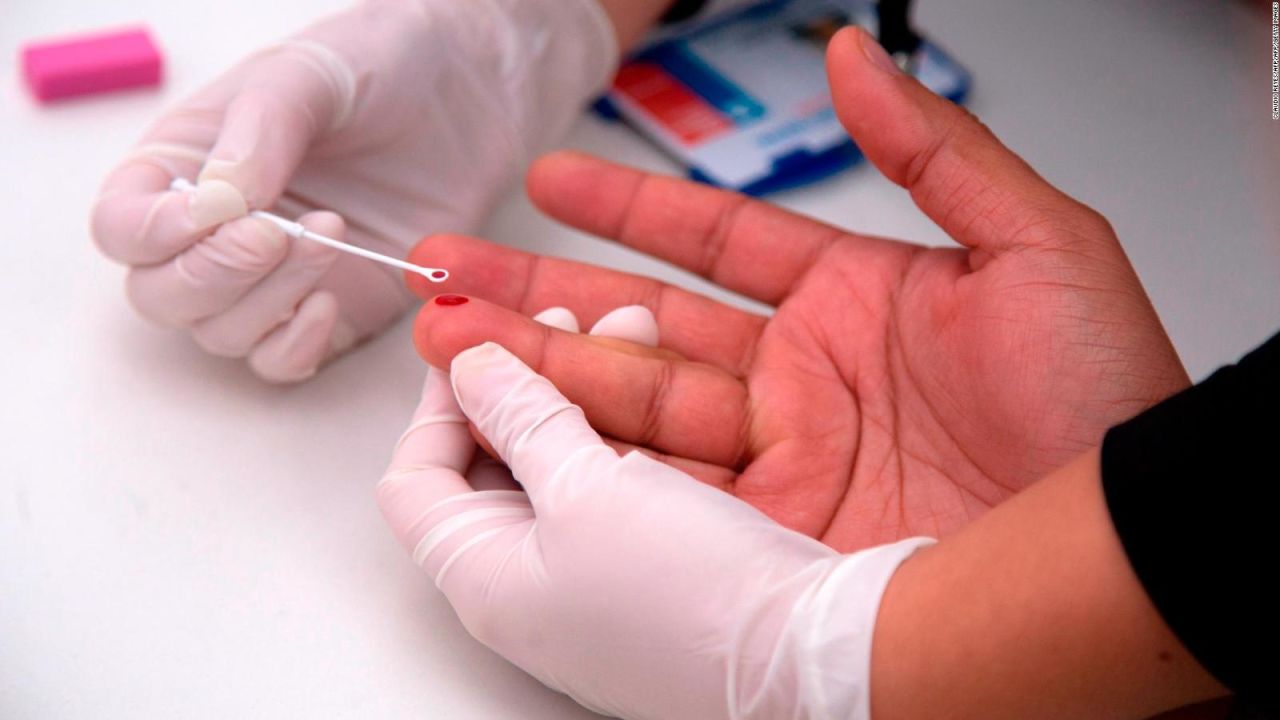 Doctor habla de la importancia de la accesibilidad a tratamientos para el VIH en EE.UU., donde hay más de 30.000 nuevas infecciones anuales | CNN