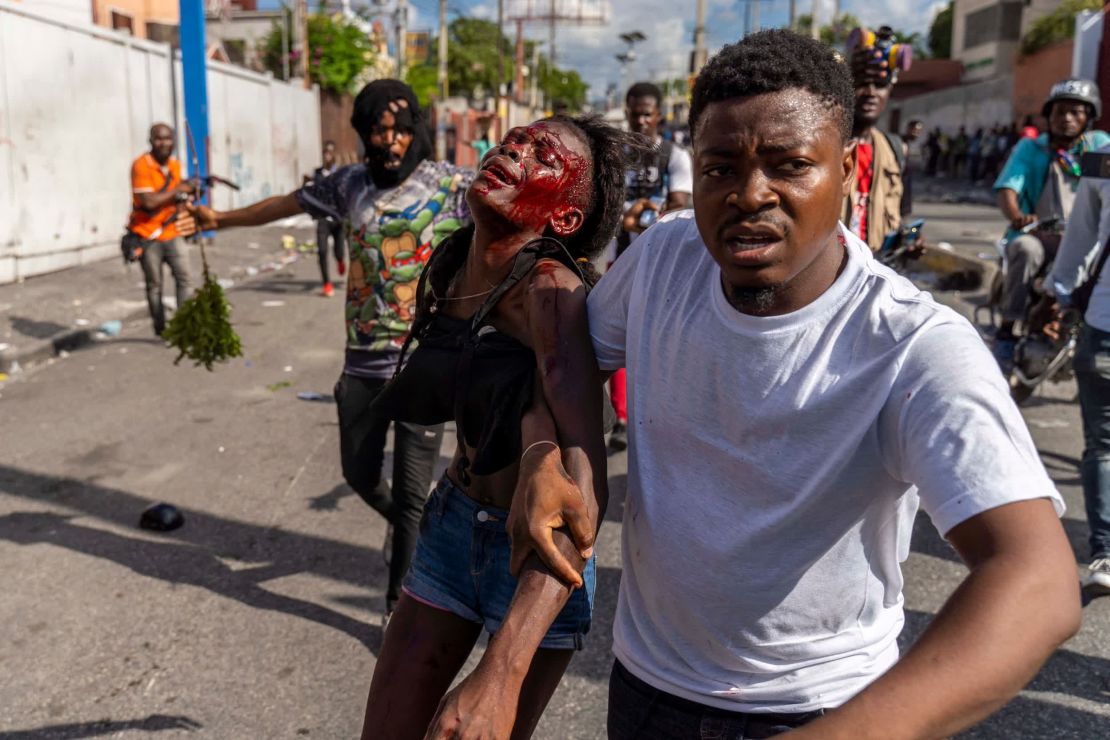 Un hombre ayuda a una mujer herida en Port-au-Prince, Haití, durante una protesta que pide la renuncia del primer ministro haitiano Ariel Henry. Henry pidió apoyo internacional mientras la nación lidiaba con un brote de cólera, escasez de alimentos y combustible, protestas generalizadas y violencia de pandillas sin control. Foto: Richard Pierrin/AFP/Getty Images