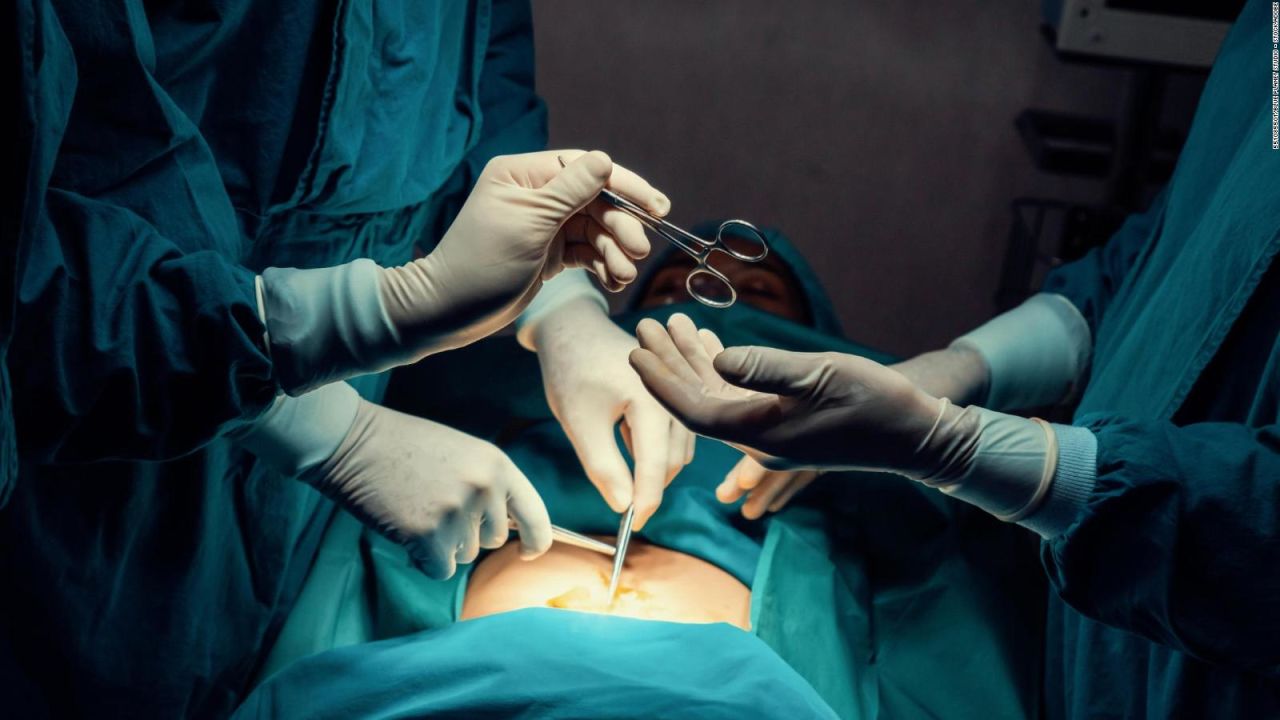 CNNE 1328142 - ¿cuales son las cirugias esteticas mas populares en el mundo?