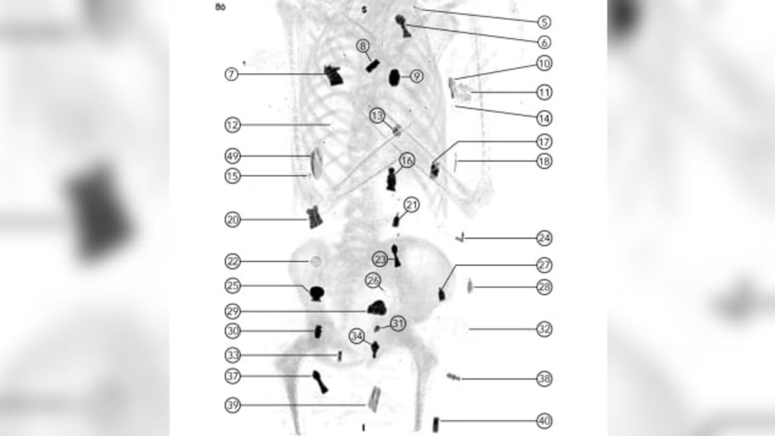 Los amuletos se colocaban sobre el cuerpo y se metían dentro de él. Cortesía de Frontiers Press