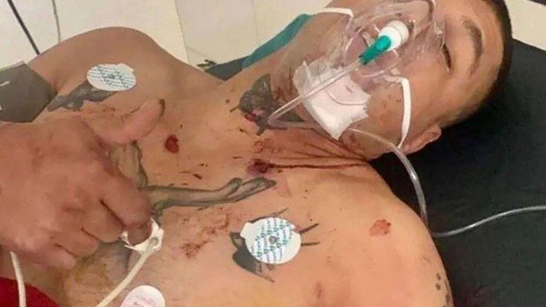 El boxeador kurdo iraní Ashkan Morovati dice que pasó casi un mes en el hospital tras ser golpeado y tiroteado por las fuerzas del régimen iraní. Cortesía de Ashkan Morovati