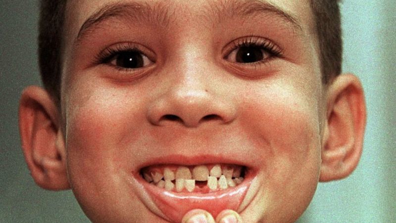 La historia de elián gonzález, el 'balserito' que quedó bajo un fuego cruzado entre ee. Uu. Y cuba | cnn