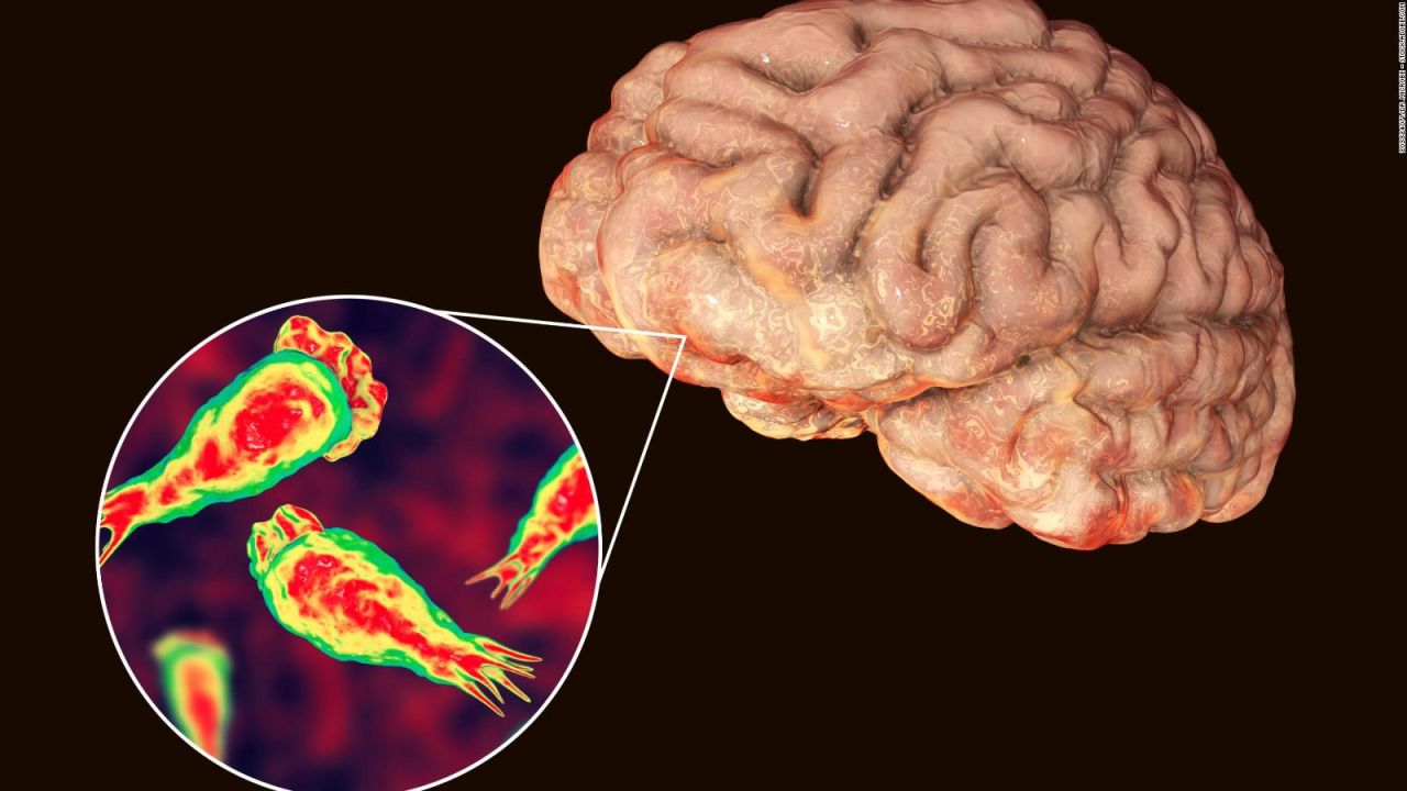 CNNE 1355398 - ¿que es y como se contrae la ameba comecerebro?