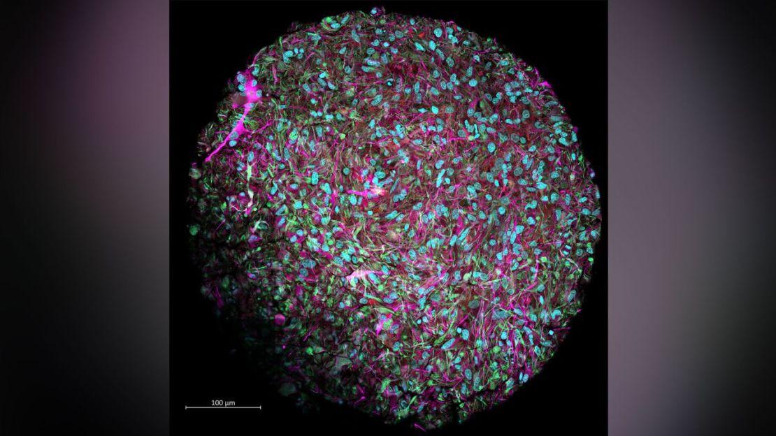 Esta imagen ampliada muestra un organoide cerebral producido en el laboratorio de Hartung. El cultivo se tiñó para mostrar las neuronas en magenta, los núcleos celulares en azul y otras células de soporte en rojo y verde.