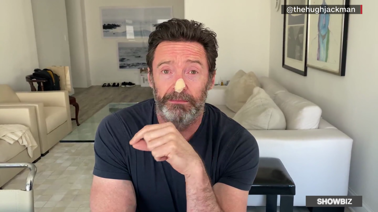 CNNE 1370829 - hugh jackman revela que se sometera a pruebas de cancer de piel