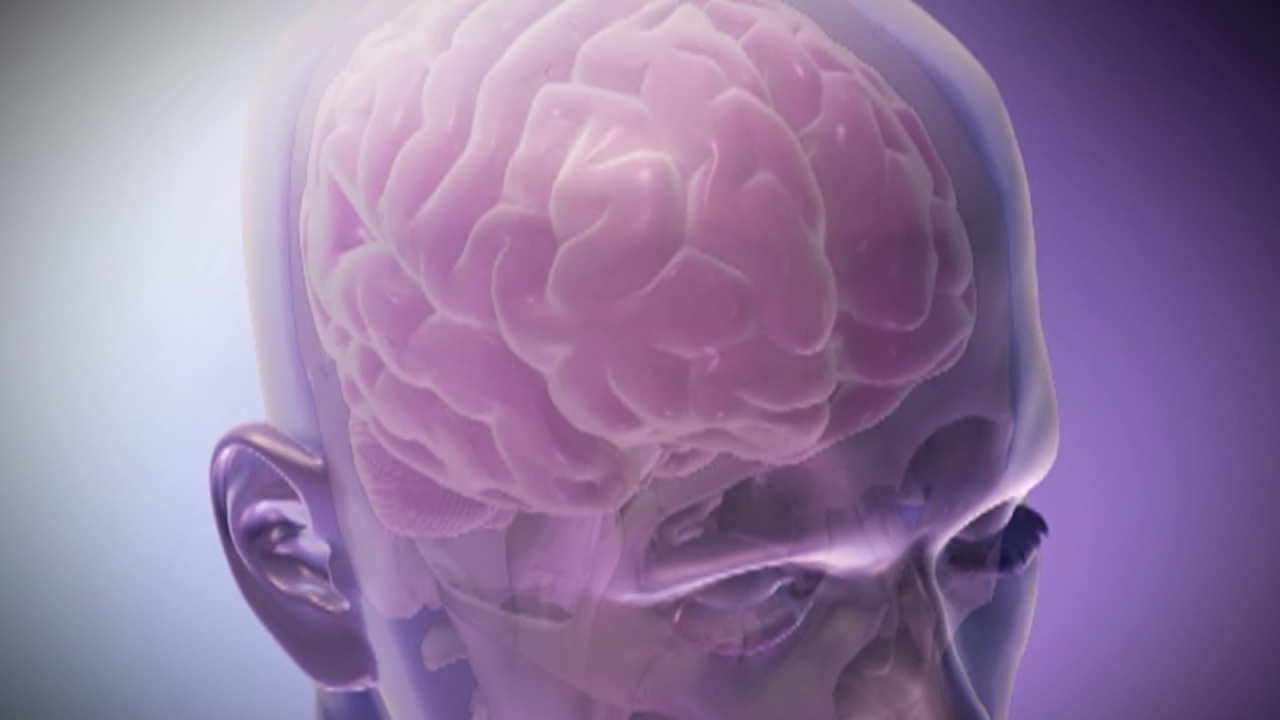 CNNE 1371534 - investigacion revela efectos a largo plazo de las lesiones cerebrales