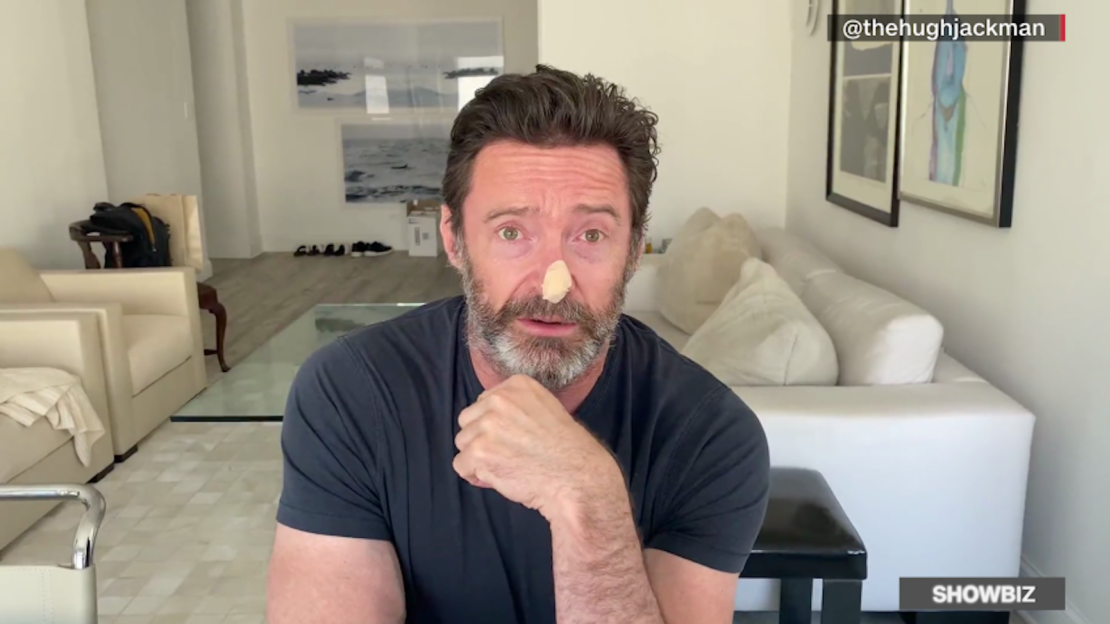 Hugh Jackman habló recientemente sobre su experiencia al hacerse una biopsia de piel.