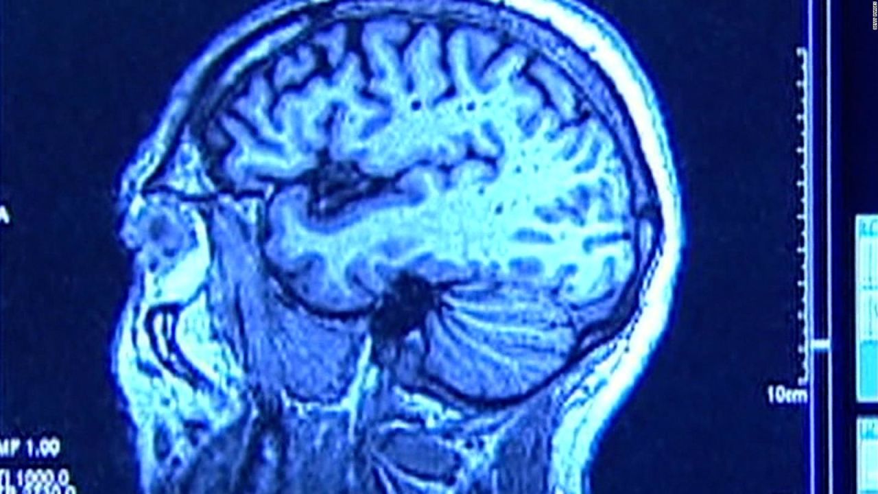 CNNE 1375880 - analizaran el cerebro del tirador del banco de louisville, kentucky