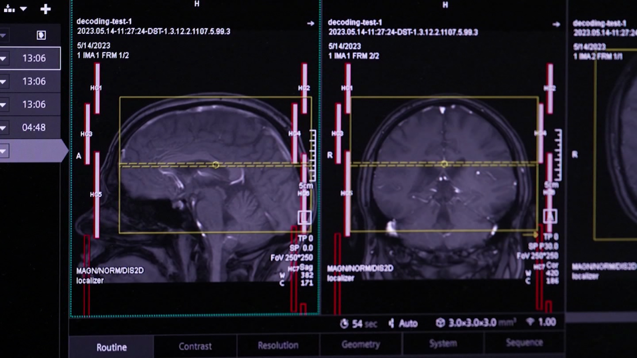 CNNE 1397728 - ¿como puede la ia 'traducir' imagenes de tu cerebro a palabras?