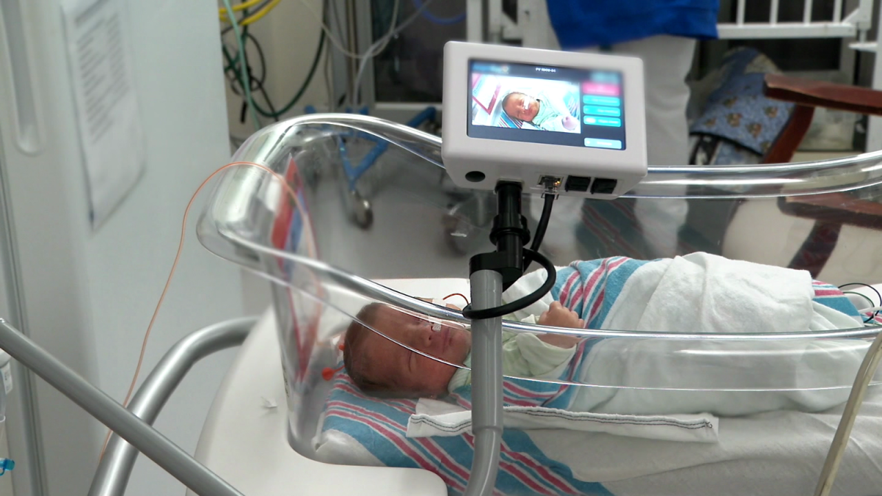 CNNE 1429171 - asi ayuda la tecnologia a padres que tienen un hijo prematuro