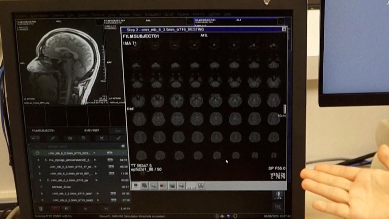 CNNE 1438078 - investigadores utilizan ia para "leer" la mente de las personas