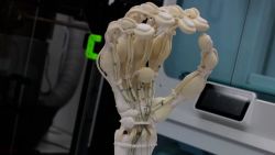 CNNE 1509343 - imprimen una mano 3d con huesos, ligamentos y tendones