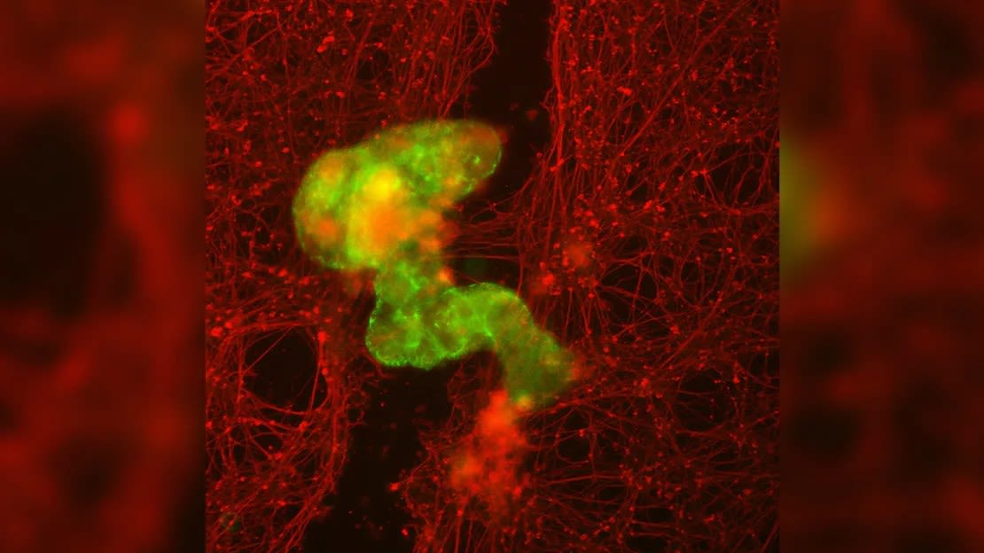 Un "anthrobot", en verde, crece a través de un rasguño a través del tejido neuronal, en rojo.