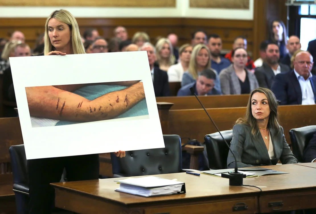 Los abogados de Karen Read dicen que los moretones en los brazos de su novio se debían a una pelea. Los fiscales dicen que son porque ella lo golpeó con su camioneta. (Foto: John Tlumacki/The Boston Globe/Getty Images).