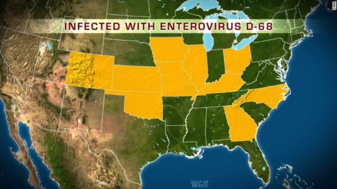 CNNE 152352 - image (1) 140908130025-enterovirus-map-0908-story-top-jpg for post 132844