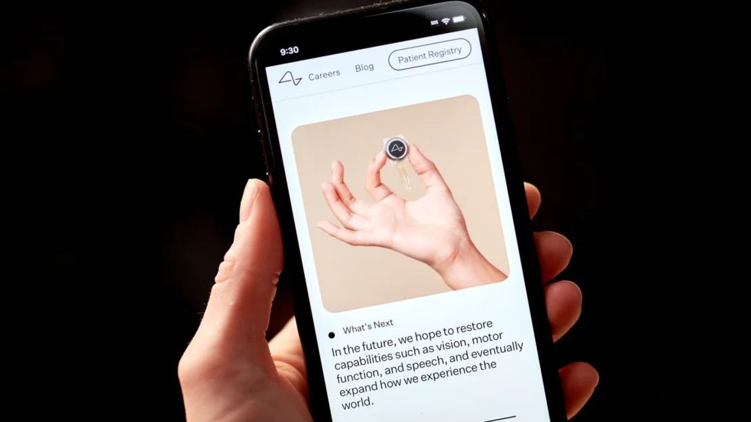 Neuralink, de Elon Musk, pretende que algún día los humanos puedan controlar ordenadores con la mente. Gabby Jones/Bloomberg/Getty Images