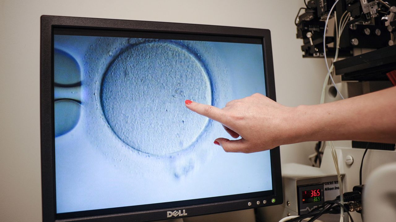 An embryologist shows an Ovocyte after it was inseminated at the Virginia Center for Reproductive Medicine, in Reston, Virginia on June 12, 2019 - Freezing your eggs, getting pregnant after the age of 50, choosing the baby's sex: when it comes to in-vitro fertilization and other assisted reproduction procedures in the United States, would-be parents are spoilt for choice. This isn't the case in many other countries, including , which is hoping to  legislation that would let single women and lesbian couples benefit from these technologies for the first time. (Photo by Ivan Couronne / AFP) / TO GO WITH AFP STORY by Ivan COURONNE, "In US, relaxed IVF laws help would-be parents realize dreams"