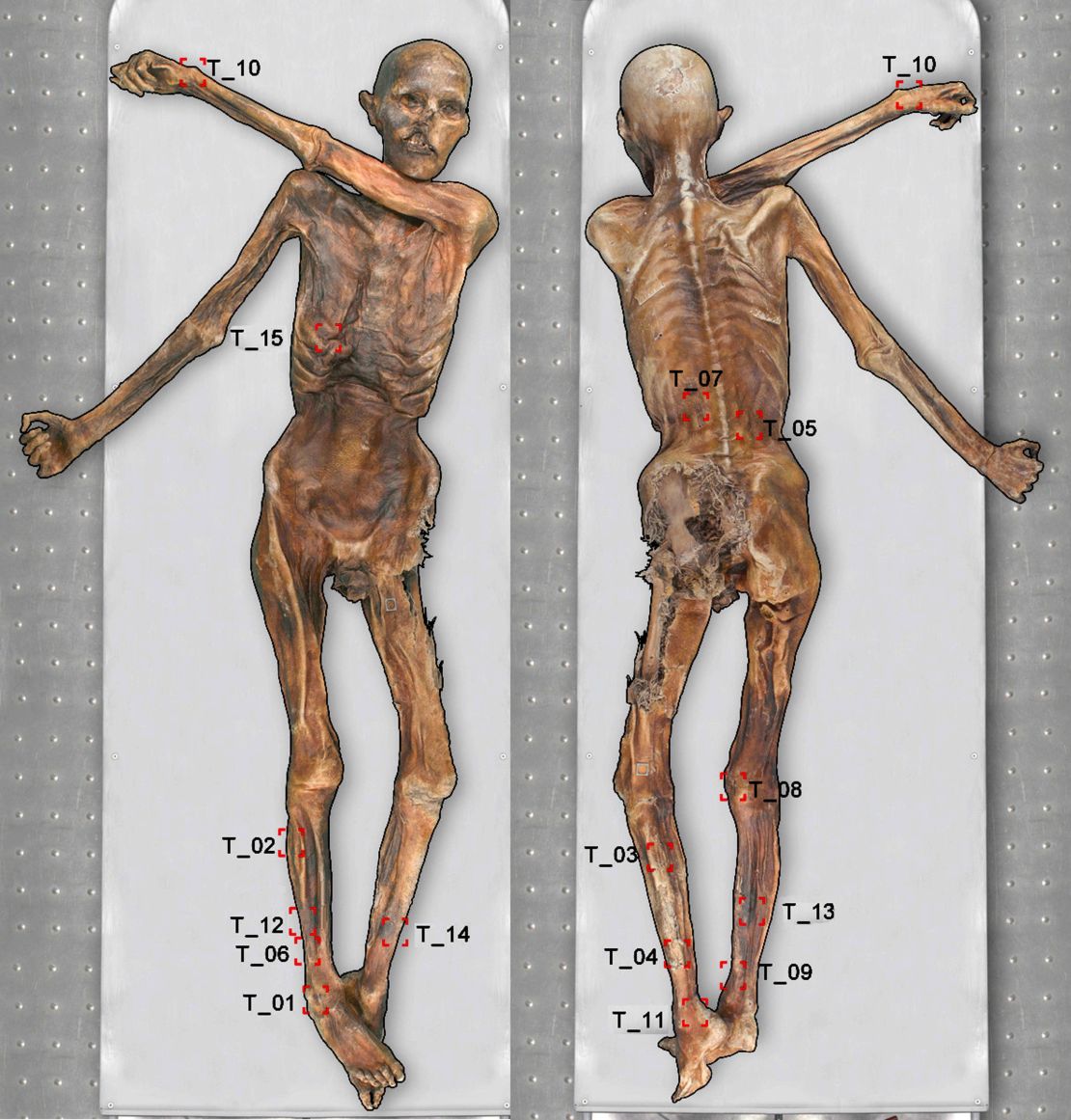 Ötzi tenía tatuajes en varias zonas de su cuerpo. Crédito: Instituto de Investigación EURAC para Estudios de Momias/Marco Samadelli.