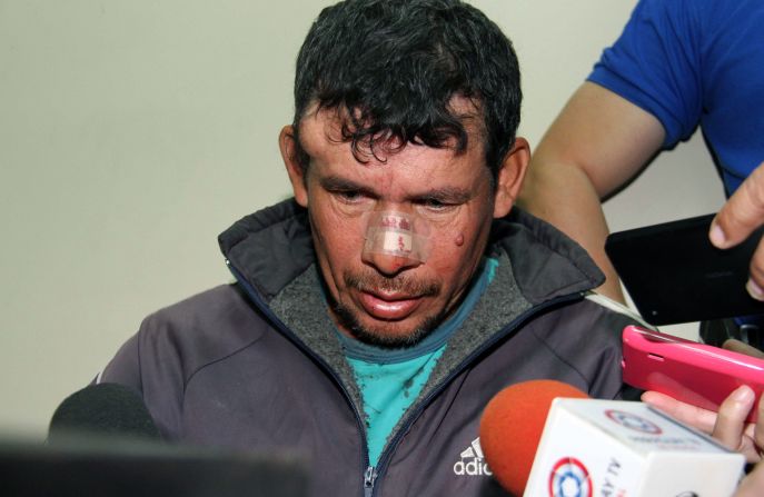 Gilberto Benítez Zárate, acusado de violar a su hijastra de 10 años de edad, fue detenido por la policía de Paraguay en Caazapá, a unos 300 kilómetros de Asunción.