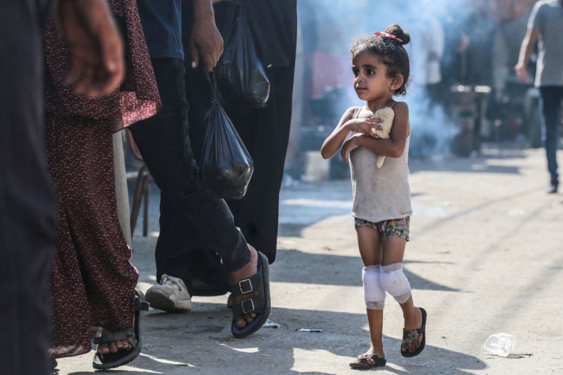 Una niña palestina con las rodillas vendadas sostiene un trozo de masa contra su pecho mientras camina por una calle en Deir al-Balah, en el centro de Gaza, el 13 de junio de 2024- (Foto: BASHAR TALEB/AFP vía Getty Images).