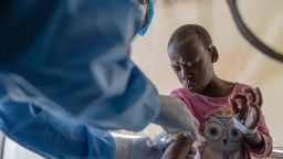 Un trabajador sanitario atiende a un paciente con mpox en Munigi, al este del Congo, el 19 de agosto de 2024. (Moses Sawasawa/AP).