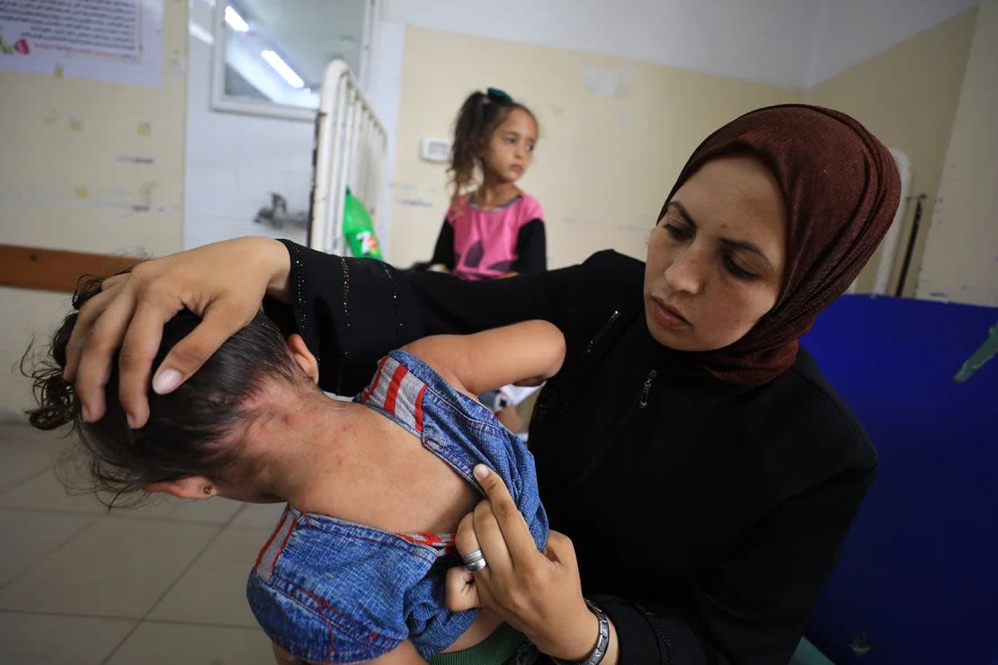 A una niña palestina le diagnostican una infección cutánea en Gaza el 26 de julio. Los trabajadores sanitarios afirman que los niños contraen infecciones cutáneas por el agua contaminada y a la falta de a instalaciones sanitarias. Cortesía: Dawoud Abo Alkas/Anadolu/Getty Images