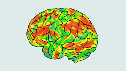 En una representación artística de un cerebro real bajo los efectos de la psilocibina, los puntos rojos y amarillos son los lugares en los que el cerebro dispara en el momento álgido del viaje psicodélico. Crédito: CNN
