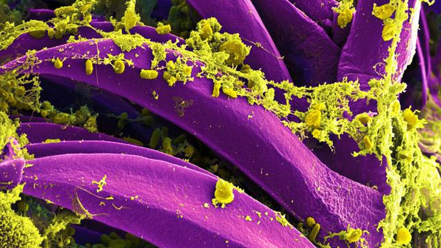 La bacteria que causa la peste, la 'Yersinia pestis', se encuentra en zonas donde hay roedores silvestres (National Institute of Allergy And Infectious Diseases).