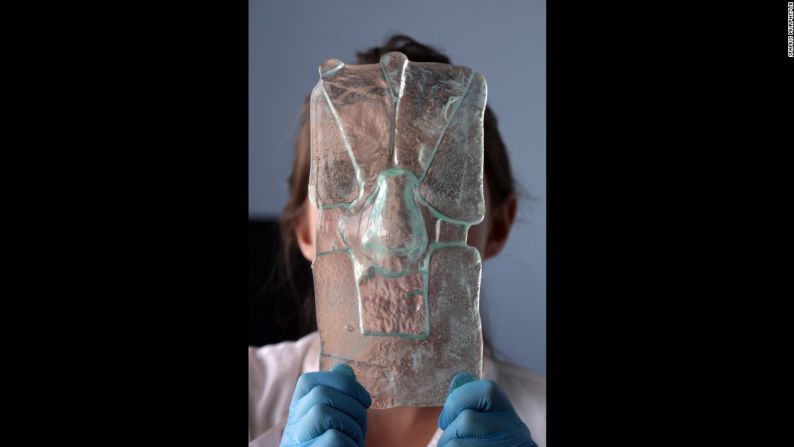 La investigadora Claire Crowley sostiene un molde de vidrio de la nariz de un paciente, que es usada para crear una nueva nariz.