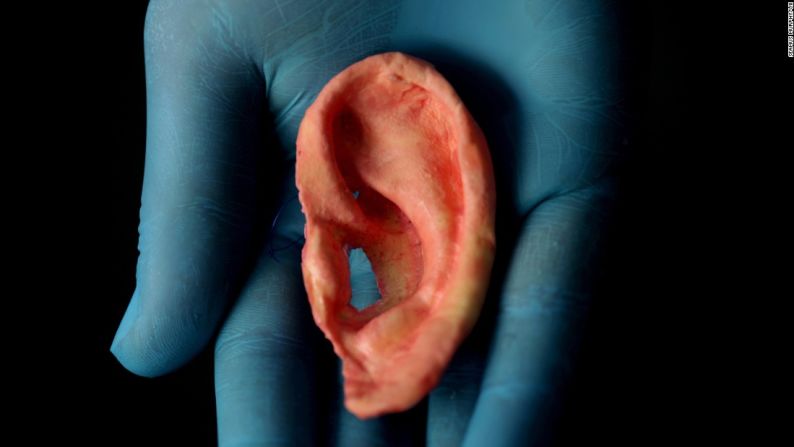 Una oreja hecha con material nanocompuesto.