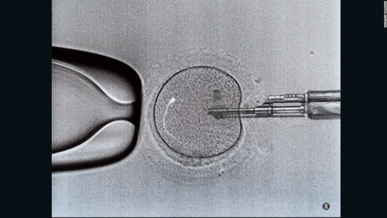 Microscopic Genocide (Genocidio microscópico) – "La selección inusual".