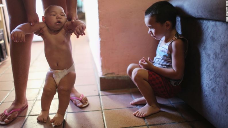 David Henrique Ferreira, un bebé de 5 meses con microcefalia, junto a su hermano en Recife, Brasil, el 25 de enero. Desde noviembre, Brasil registra casi 4.000 casos de microcefalia en bebés nacidos con madres infectadas con virus del Zika, que afecta el desarrollo en bebés.