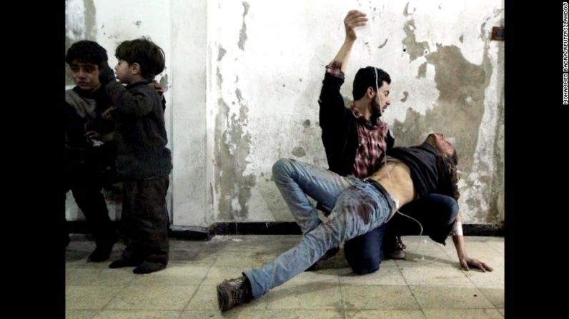 Atención médica desesperada para un joven en el hospital de Douma, Siria, el 2 de febrero de 2015.