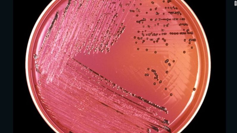 La 'zona de peligro' es entre 40 y 140 grados Fahrenheit ya que este es el rango de temperatura ideal para que las bacterias se multipliquen. En la foto, la Salmonella que crece en una placa de Petri.