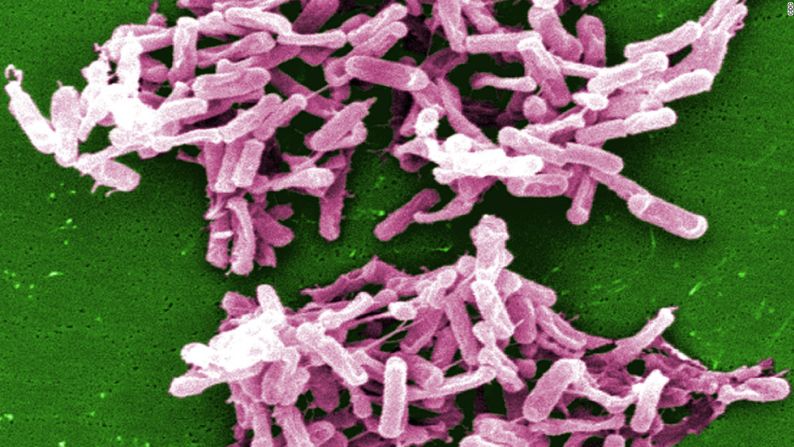 1 de cada 6 personas en Estados Unidos se enferma a causa de enfermedades transmitidas por los alimentos así que aquí tienes un freno para saber cómo combatir esas desagradables bacterias. En la foto, la bacteria Clostridium difficile.