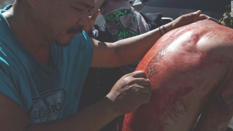 Personal de primeros auxilios están en el lugar, para ayudar a aquellos que colapsan por el calor, la deshidratación, además para tratar sus heridas.