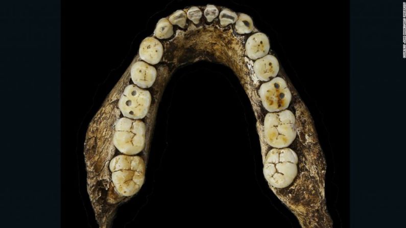 Los dientes del Homo naledi eran pequeños, y por su descripción se determinó que están dentro del género Homo.