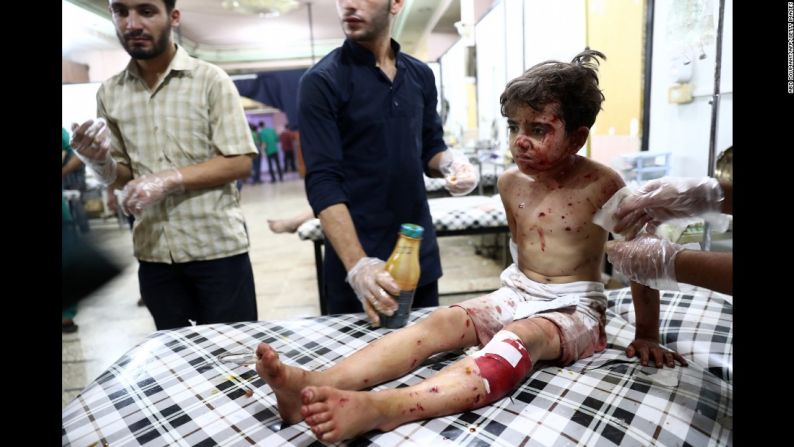 Niño herido en Siria — Este niño herido recibe primeros auxilios en un improvisado hospital luego de un ataque aéreo en la ciudad de Douma, Siria, el 23 de agosto de 2016. Es el quinto año de la guerra civil en Siria, según el Centro Siria para la Investigación Política, que estima que la cifra de muertes se ha elevado a 470.000.