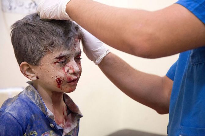 Un médico atiende a un niño herido en un bombardeo en el este de Aleppo. (Crédito KARAM AL-MASRI/AFP/Getty Images).