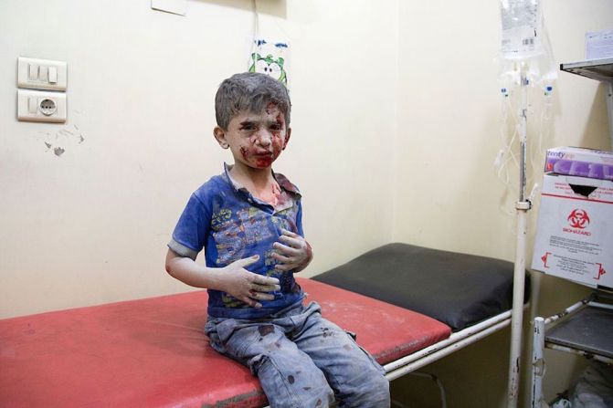 Un pequeño herido por la ola de bombardeos contra la zona este de Aleppo.(Crédito KARAM AL-MASRI/AFP/Getty Images).